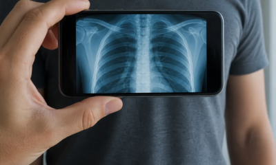 Transforme seu Celular em um Aparelho de Raio X