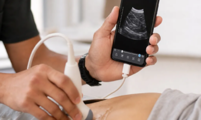 Ultrassom pelo Celular: Tecnologia ao Seu Alcance