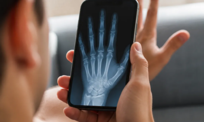 Faça Raio X Usando Apenas seu Celular com o APP