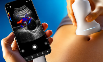 Ultrassom pelo Celular: Tecnologia ao Alcance