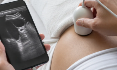 Ultrassom pelo Celular: App Prático e Seguro