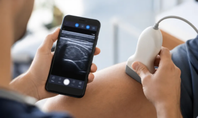 Ultrassom pelo Celular: Tecnologia Portátil