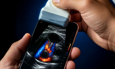 Ultrassom pelo Celular: Como Funciona